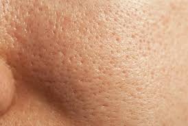 Oily/ Acne Skin